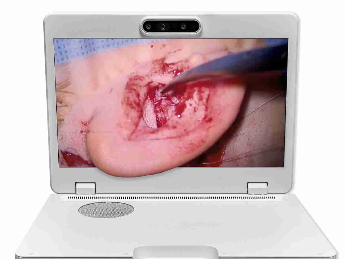 达擎之＂Heads-up 3D显微手术显示系统＂，，，，整合4K裸眼3D显示及眼球追踪系统，，，具备快速追踪人眼移动位置功能，，，，减轻医师长时间维持固定姿势的负担，，让医师能有更宽广清晰的3D立体视野及更舒适的姿势来执行手术。。。